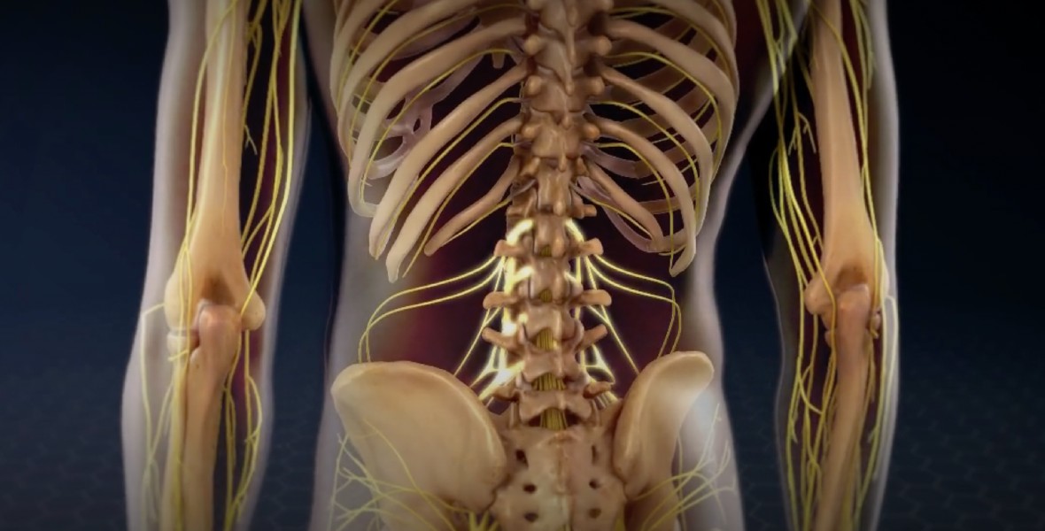 Lumbar Laminectomy Surgery in Dallas, TX